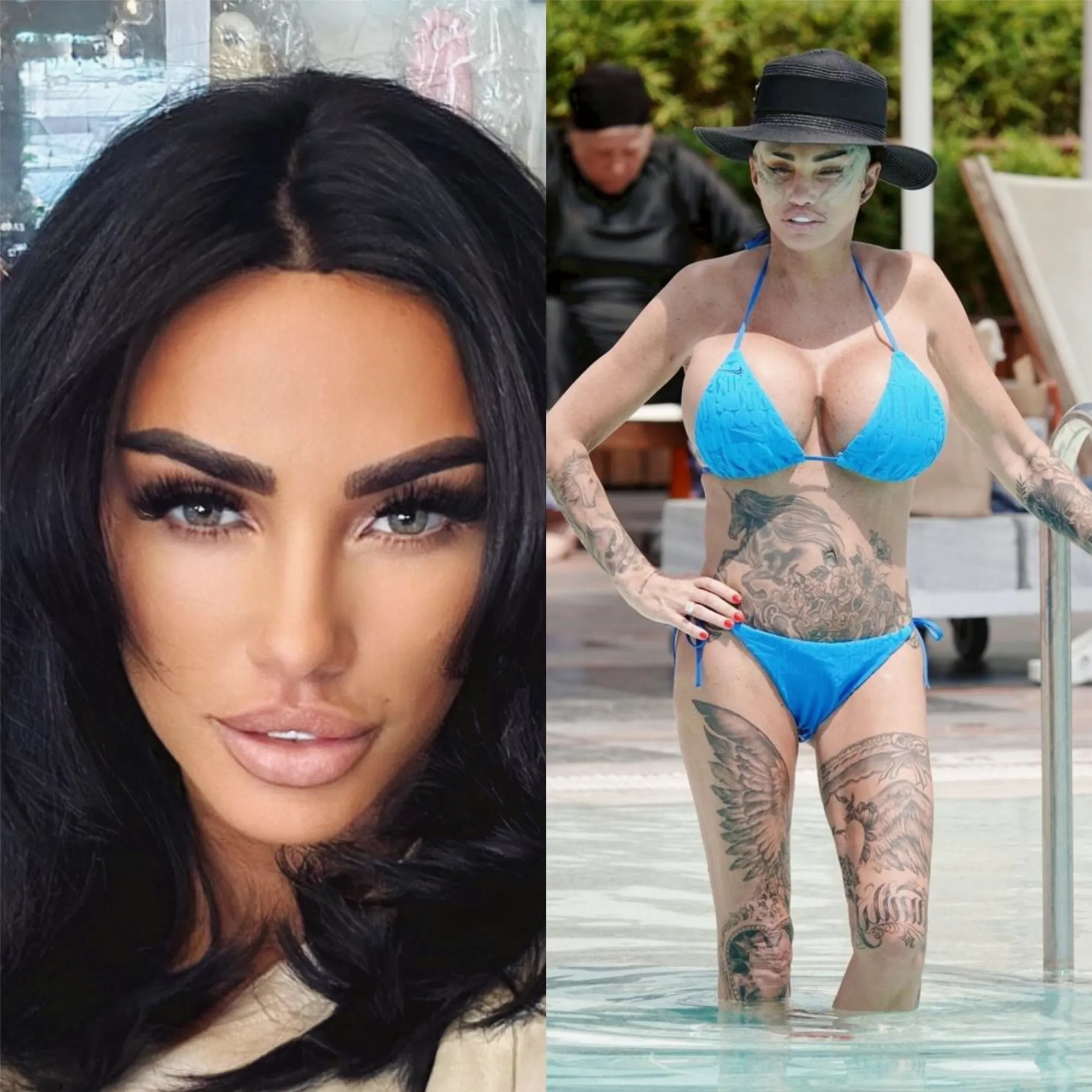 British Model Shocks with “Massive Bust” After 17th Enhancement Surgery