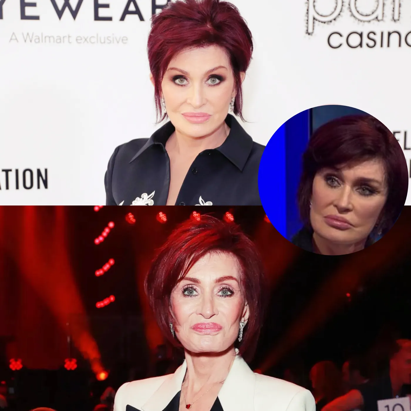 Sharon Osbourne’s Altered Appearance – Cosmetic Surgery or a Disaster?