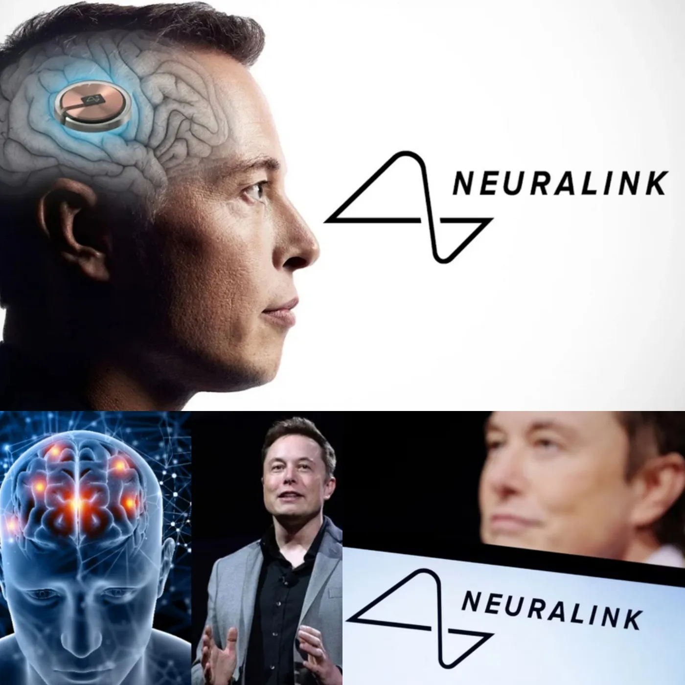 Canada Approves Elon Musk’s Neuralink to Trial Brain Chip Implant in Humans